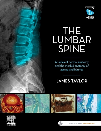 [object Object] «The Lumbar Spine: An Atlas of Normal Anatomy and the Morbid Anatomy of Ageing and Injury», автор Джеймс Тейлор - фото №1