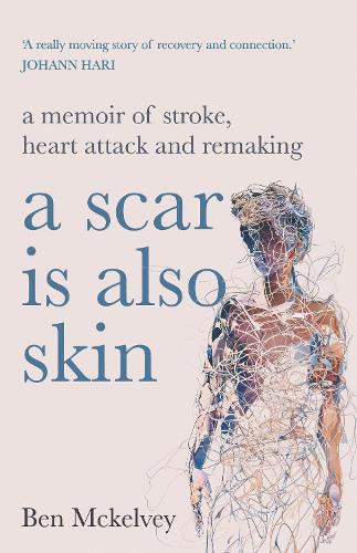 Паперова книга «A Scar is Also Skin: A memoir of stroke, heart attack and remaking», автор Бен Маккелві - фото №1