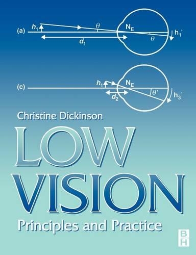 Бумажная книга «Low Vision: Principles and Practice», автор Кристин Дикинсон - фото №1
