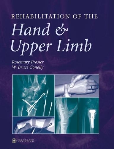 Бумажная книга «Rehabilitation of the Hand and Upper Limb», авторов Розмари Проссер, У. Брюс Конолли - фото №1