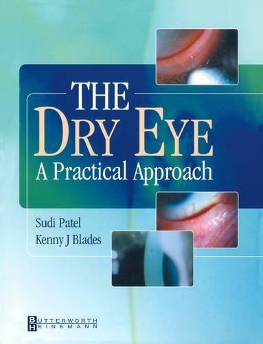 Паперова книга «The Dry Eye: A Practical Approach», авторів Кенні Блейдс, Суді Патель - фото №1