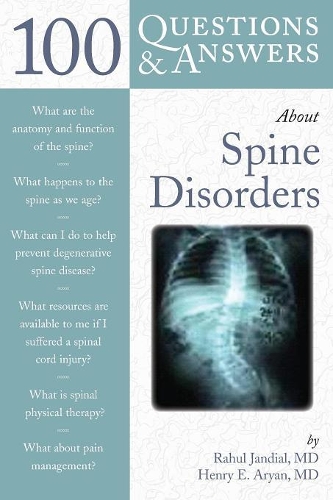 Паперова книга «100 Questions  &  Answers About Spine Disorders», автор Генрі Е. Аріан - фото №1