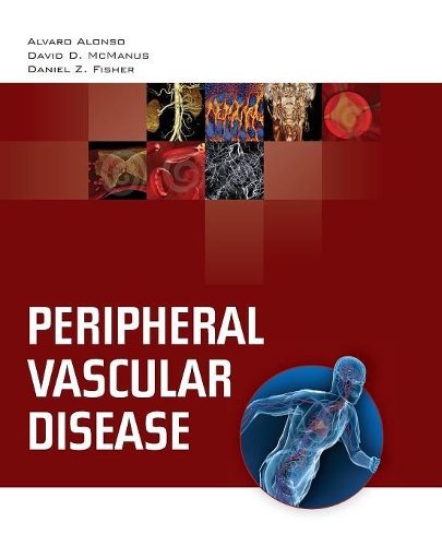 Бумажная книга «Peripheral Vascular Disease», авторов Альваро Алонсо, Дэниел Д. Макманус, Дэниел З. Фишер - фото №1