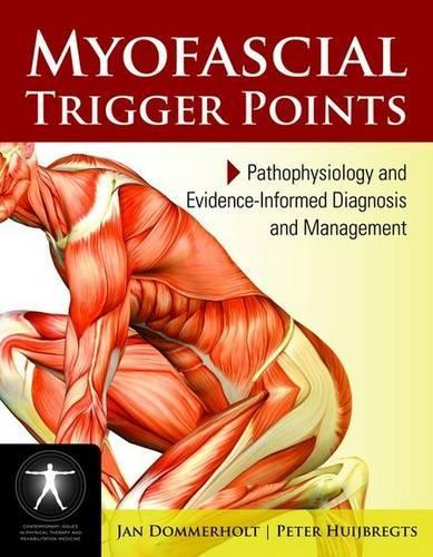 Бумажная книга «Myofascial Trigger Points: Pathophysiology And Evidence-Informed Diagnosis And Management», автор Питер Гюйбрегтс - фото №1
