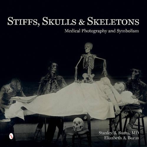 Бумажная книга «Stiffs, Skulls & Skeletons: Medical Photography and Symbolism», авторов Элизабет А. Бернс, Стэнли Б. Бернс - фото №1