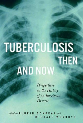 Бумажная книга «Tuberculosis Then and Now: Perspectives on the History of an Infectious Disease», авторов Флюрин Кондрау, Майкл Ворбойс - фото №1