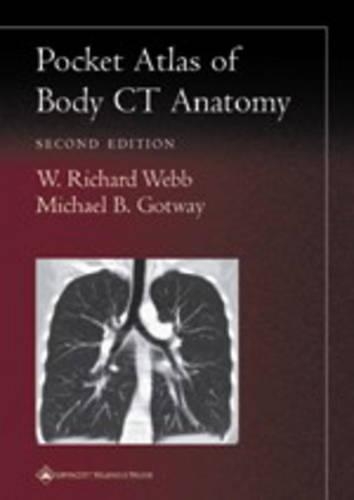 Бумажная книга «Pocket Atlas of Body CT Anatomy», авторов Майкл Б. Готуэй, В. Ричард Вебб - фото №1