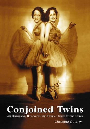 Паперова книга «Conjoined Twins: An Historical, Biological and Ethical Issues Encyclopedia», автор Крістін Квіглі - фото №1