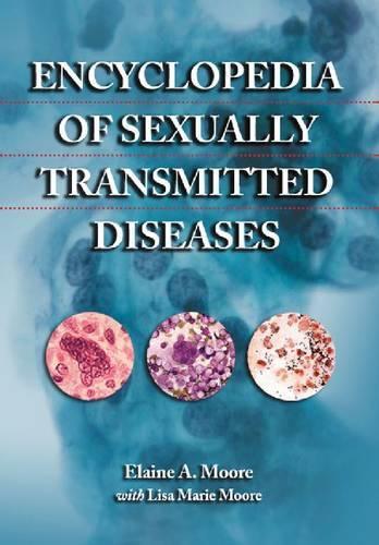Паперова книга «Encyclopedia of Sexually Transmitted Diseases», авторів Елейн А. Мур, Ліза Марі Мур - фото №1