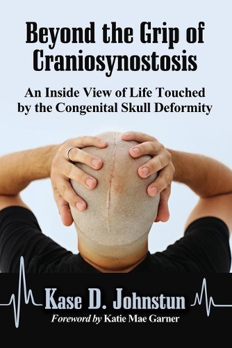 Бумажная книга «Beyond the Grip of Craniosynostosis: An Inside View of Life Touched by the Congenital Skull Deformity», автор Касе Д. Джонстун - фото №1