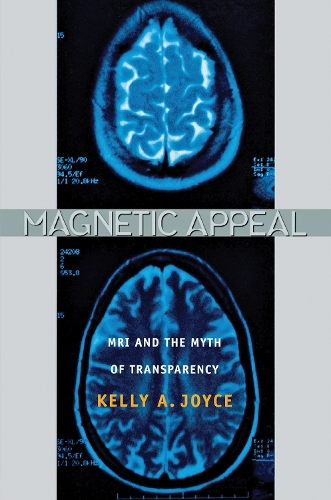 Бумажная книга «Magnetic Appeal: MRI and the Myth of Transparency», автор Келли Джойс - фото №1