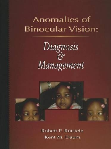 Паперова книга «Anomalies Of Binocular Vision: Diagnosis And Management», авторів Кент М. Даум, Роберт П. Рутштейн - фото №1