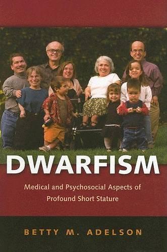 Паперова книга «Dwarfism: Medical and Psychosocial Aspects of Profound Short Stature», автор Бетті М. Адельсон - фото №1