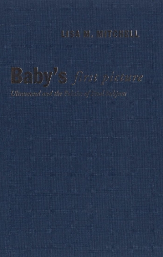Бумажная книга «Baby's First Picture: Ultrasound and the Politics of Fetal Subjects», автор Лиза М. Митчелл - фото №1