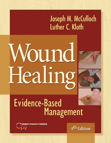 Бумажная книга «Wound Healing: Evidence-Based Management», авторов Джозеф Маккалох, Лютер К. Kloth - фото №1