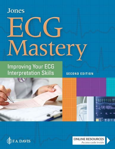 Паперова книга «ECG Mastery: Improving Your ECG Interpretation Skills», автор Ширлі А. Джонс - фото №1
