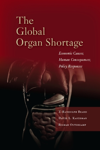 Бумажная книга «The Global Organ Shortage: Economic Causes, Human Consequences, Policy Responses», авторов Дэвид Л. Казерман, Ригмар Остеркамп, Т. Рэндольф Бирд - фото №1