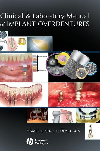 Паперова книга «Clinical and Laboratory Manual of Implant Overdentures», автор Хамід Р. Шафі - фото №1