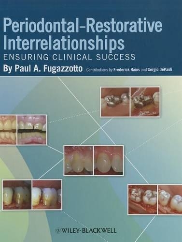 Паперова книга «Periodontal-Restorative Interrelationships: Ensuring Clinical Success», автор Пол А. Фугаццотто - фото №1