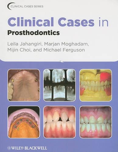 Бумажная книга «Clinical Cases in Prosthodontics», авторов Лейла Джахангири, Марьян Могадам, Майкл Фергюсон, Миджин Чой - фото №1