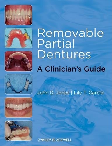 Паперова книга «Removable Partial Dentures: A Clinician's Guide», авторів Джон Д. Джонс, Лілі Т. Гарсія - фото №1