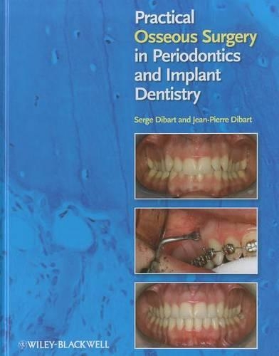 Бумажная книга «Practical Osseous Surgery in Periodontics and Implant Dentistry», авторов Жан-Пьер Дибарт, Серж Дибарт - фото №1