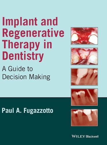 Бумажная книга «Implant and Regenerative Therapy in Dentistry: A Guide to Decision Making», автор Пол А. Фугаццотто - фото №1