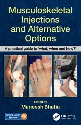 Бумажная книга «Musculoskeletal Injections and Alternative Options: A practical guide to 'what, when and how?'» - фото №1