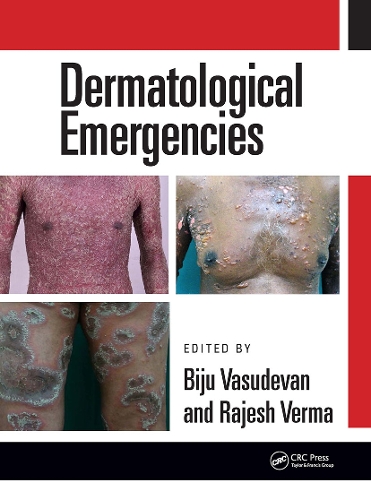 Паперова книга «Dermatological Emergencies» - фото №1