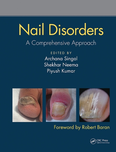 Бумажная книга «Nail Disorders: A Comprehensive Approach» - фото №1