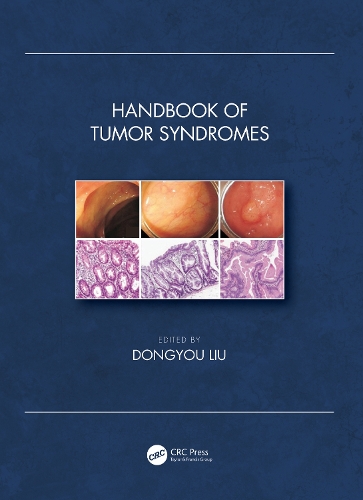 Бумажная книга «Handbook of Tumor Syndromes» - фото №1