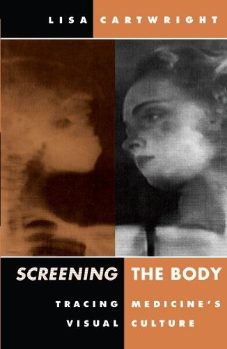 Бумажная книга «Screening the Body: Tracing Medicine's Visual Culture», автор Лиза Картрайт - фото №1