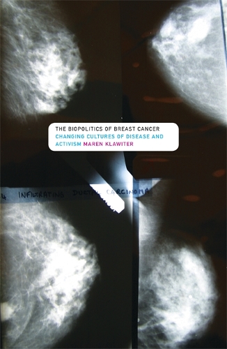 Бумажная книга «The Biopolitics of Breast Cancer: Changing Cultures of Disease and Activism», автор Марен Клавитер - фото №1