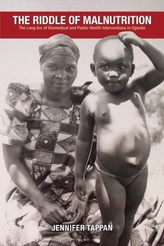 Бумажная книга «The Riddle of Malnutrition: The Long Arc of Biomedical and Public Health Interventions in Uganda», автор Дженнифер Таппан - фото №1