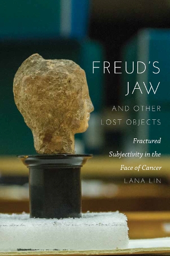 Бумажная книга «Freud's Jaw and Other Lost Objects: Fractured Subjectivity in the Face of Cancer», автор Лана Лин - фото №1