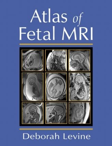 Паперова книга «Atlas of Fetal MRI», автор Дебора Левін - фото №1