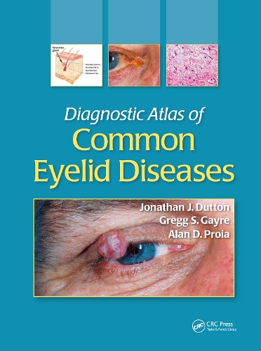 Бумажная книга «Diagnostic Atlas of Common Eyelid Diseases», авторов Алан Д. Пройа, Грегг С. Гейр, Джонатан Дж. Даттон - фото №1