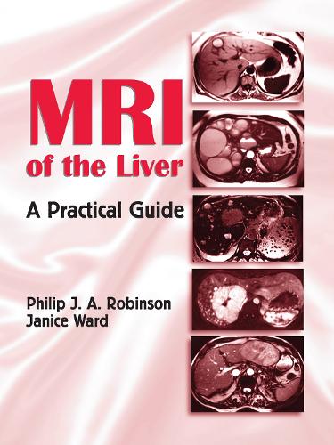 Бумажная книга «MRI of the Liver: A Practical Guide», авторов Дженис Уорд, Филип Дж. А. Робинсон - фото №1