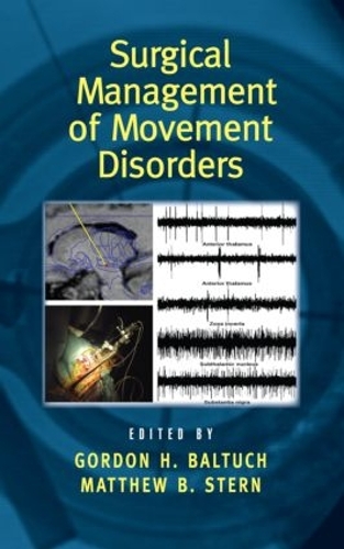 Паперова книга «Surgical Management of Movement Disorders» - фото №1