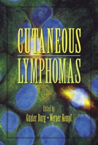 Бумажная книга «Cutaneous Lymphomas» - фото №1