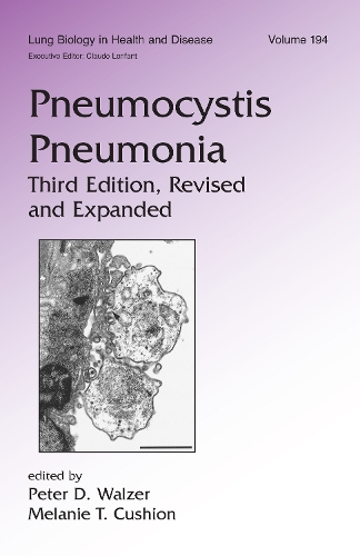 Бумажная книга «Pneumocystis Pneumonia» - фото №1