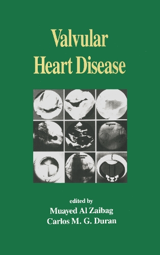 Паперова книга «Valvular Heart Disease» - фото №1