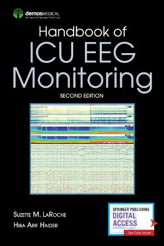 Паперова книга «Handbook of ICU EEG Monitoring», авторів Хіба Аріф Хайдер, Сюзетт М. Ларош - фото №1