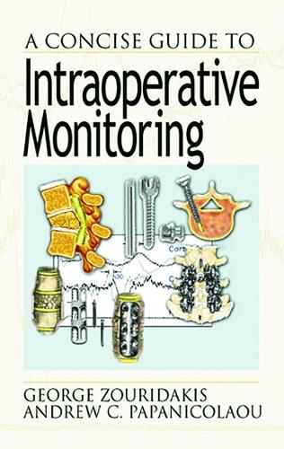 Паперова книга «A Concise Guide to Intraoperative Monitoring», автор Джордж Зоурідакіс - фото №1