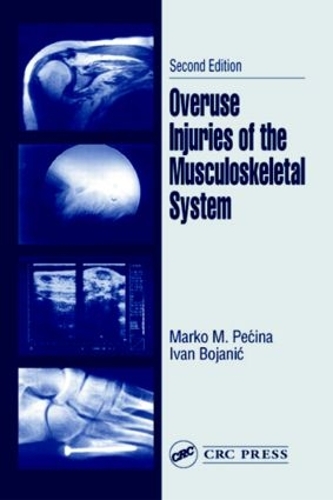 Бумажная книга «Overuse Injuries of the Musculoskeletal System», авторов Иван Боянич, Марко М. Печина - фото №1