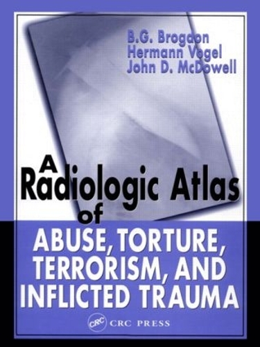Бумажная книга «A Radiologic Atlas of Abuse, Torture, Terrorism, and Inflicted Trauma», авторов B. Г. Брогдон, Джон Д. Макдауэлл - фото №1