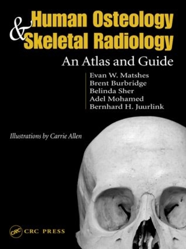 Бумажная книга «Human Osteology and Skeletal Radiology: An Atlas and Guide», авторов Бернард Юрлинк, Эван В. Мэтчес - фото №1