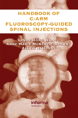 Паперова книга «The Handbook of C-Arm Fluoroscopy-Guided Spinal Injections», авторів Аллен Хорд, Енн Марі Маккензі-Браун, Лінда Хонг Ванг - фото №1