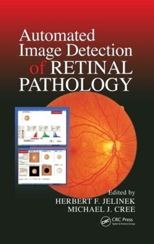 Бумажная книга «Automated Image Detection of Retinal Pathology», авторов Герберт Елинек, Майкл Дж. Кри - фото №1