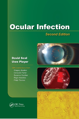 Паперова книга «Ocular Infection: Investigation and Treatment in Practice», авторів Девід В. Сіл, Уве Плейер - фото №1